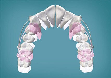 Orthodontics